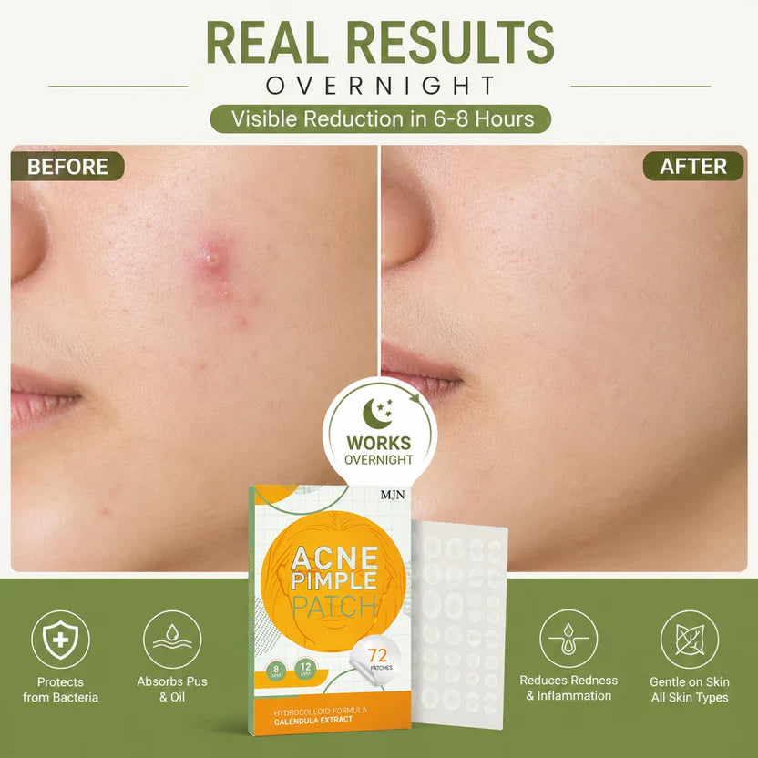 DermaSmooth Skin Tag Patches – Painless Skin Tag Removal Patches for Face & Body